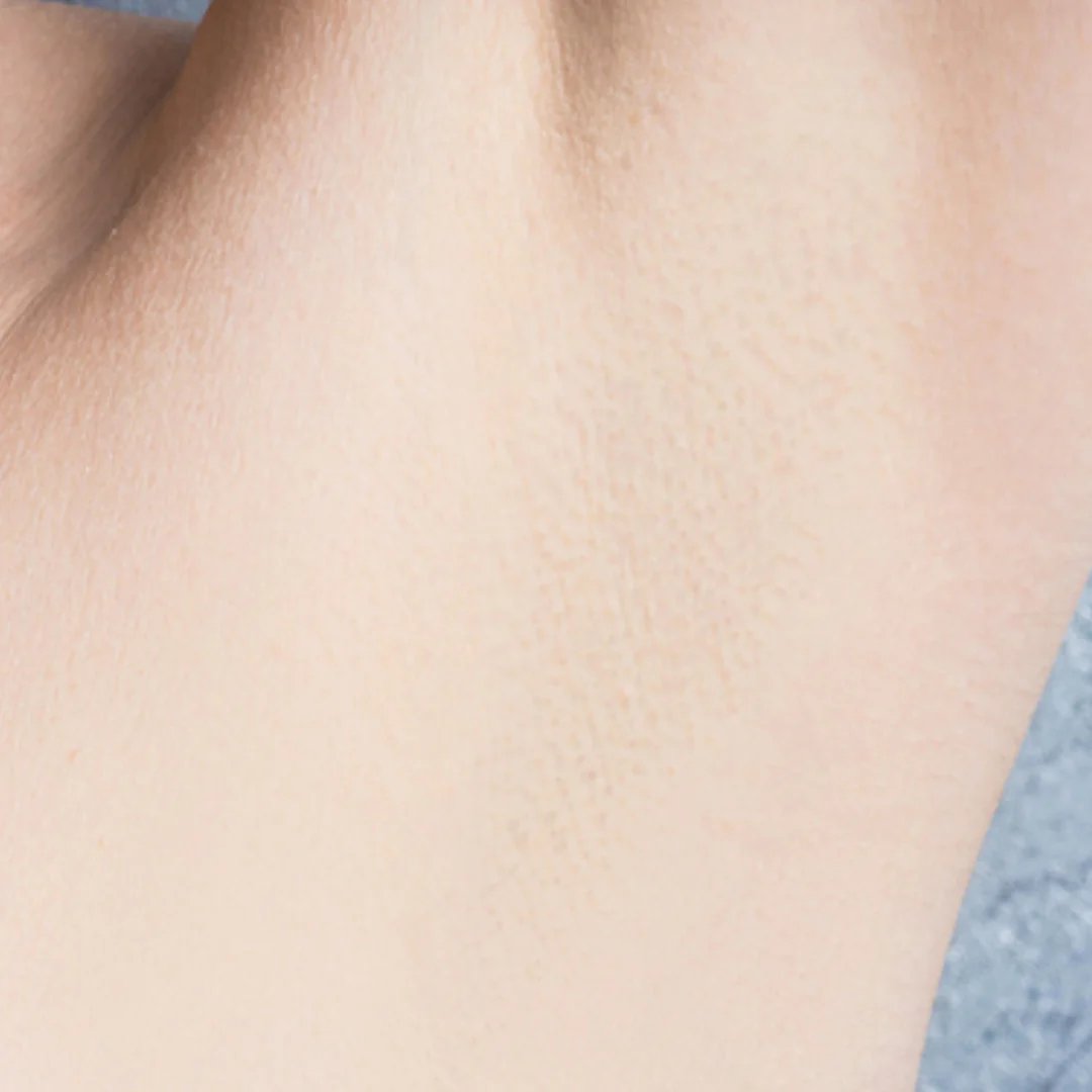 Hair Removal Formula (8).png__PID:46389fe7-ca0b-4157-8ff4-dc783574d882