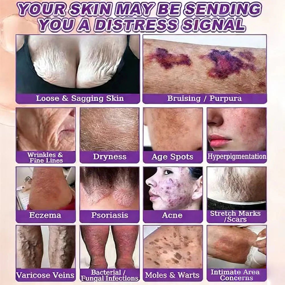 Skin distress condition chart